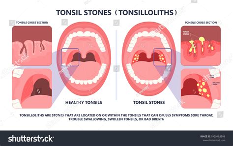 Viral and the Stones .